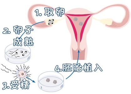 有偿捐卵供卵招聘